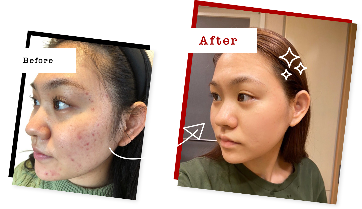 ビフォーアフター